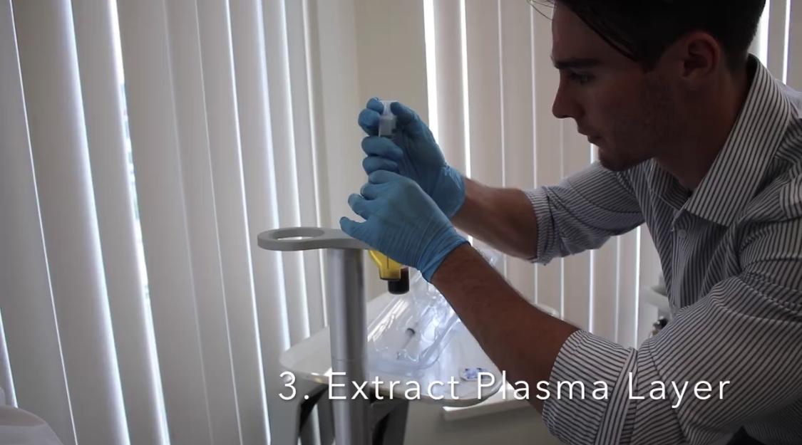 Extract plasma layer eym vancouver